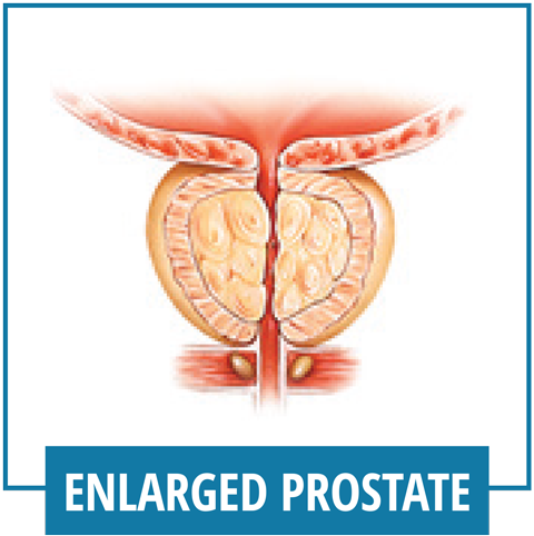 Enlarged Prostate